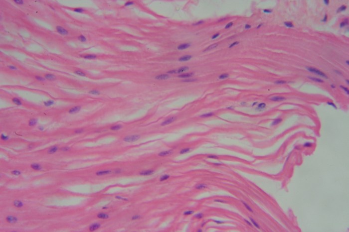 Smooth muscle under microscope 400x