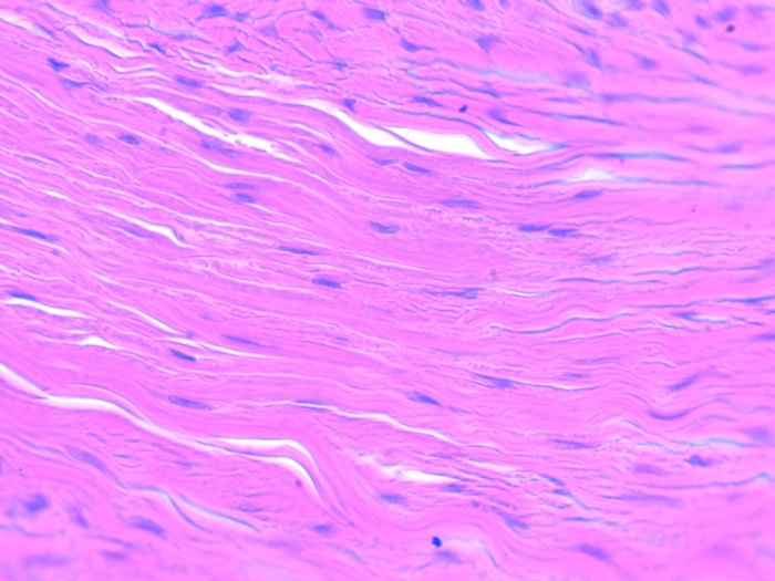 Dense regular connective tissue microscope