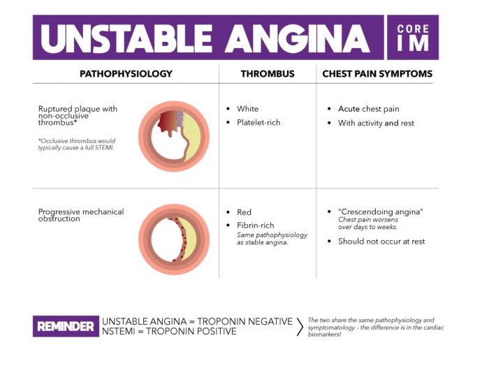 Which of the following statements about angina pectoris is true